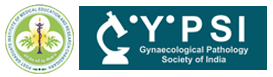 GYPSICON